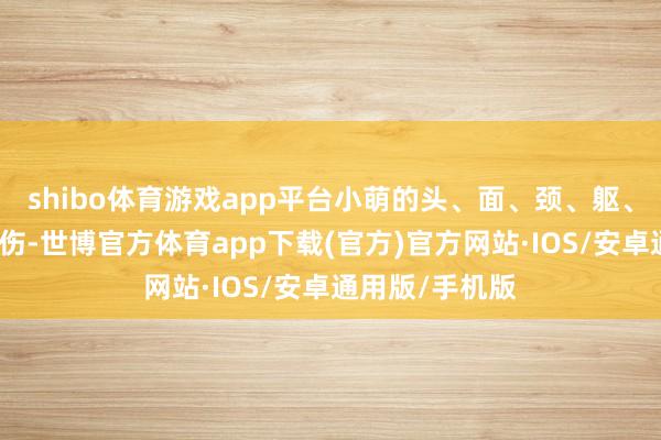 shibo体育游戏app平台小萌的头、面、颈、躯、双上肢均被烧伤-世博官方体育app下载(官方)官方网站·IOS/安卓通用版/手机版