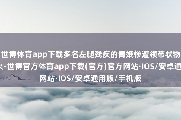 世博体育app下载多名左腿残疾的青娥惨遭领带状物体勒颈而一火-世博官方体育app下载(官方)官方网站·IOS/安卓通用版/手机版